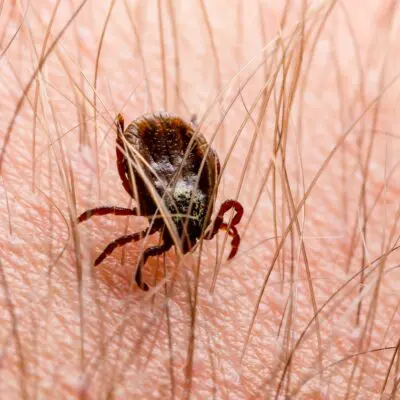 tick-borne illness