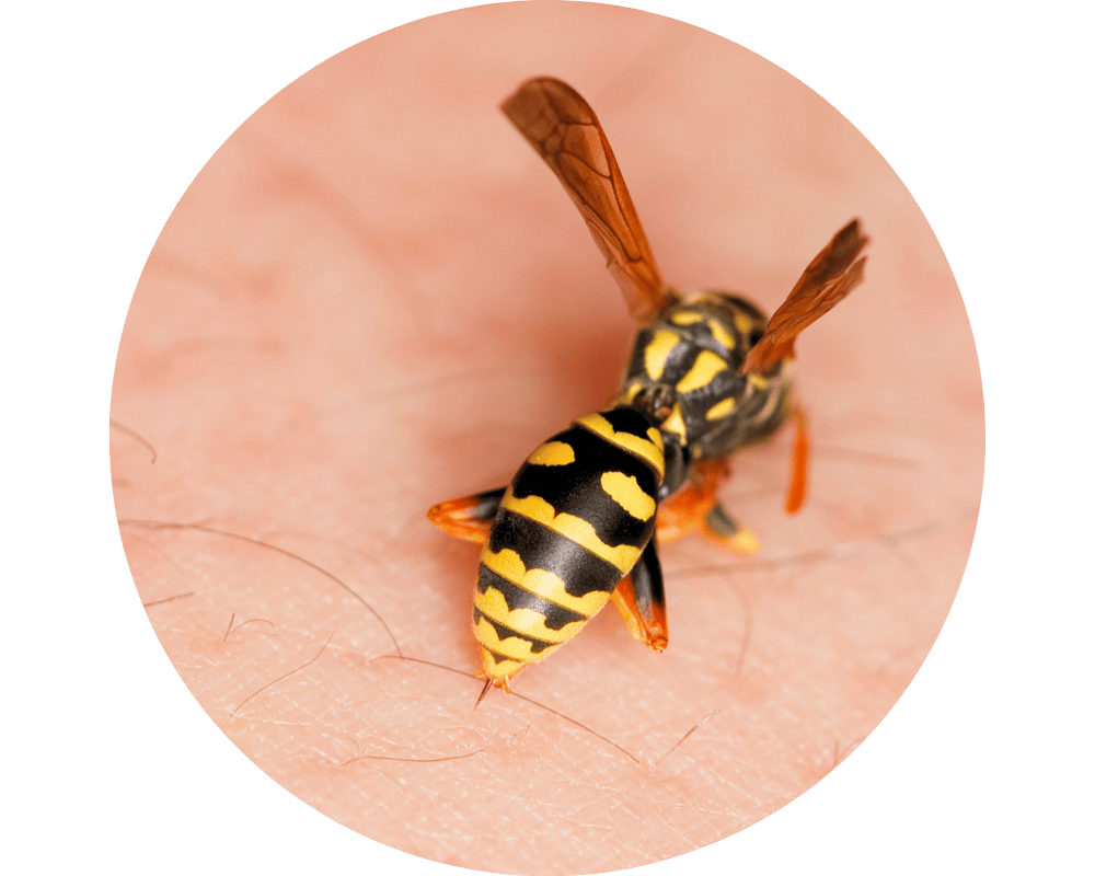 Paper Wasp Sting Circle 1 how to treat a paper wasp sting